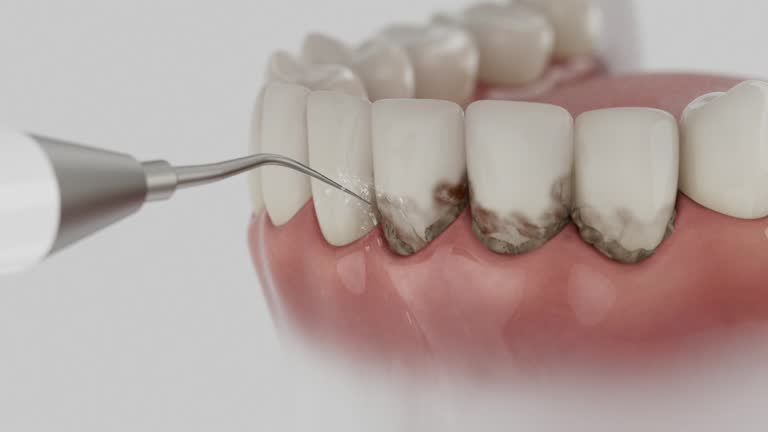 Reliable Dental Implants contractor in Alpha, NJ by Smile Center Dentistry